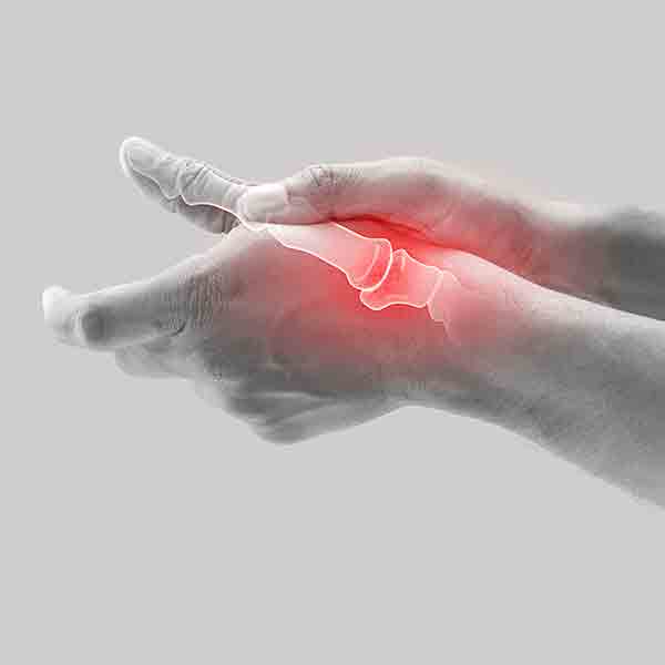 arthritis-finger-daumengelenk
